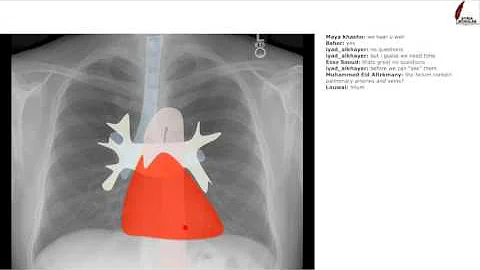 SyriaScholar "How to read a chest x-ray" live tutorial