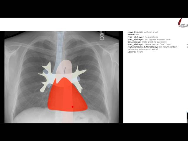SyriaScholar "How to read a chest x-ray" live tutorial