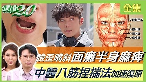 陳子強睡醒面癱腫如豬頭 半身麻痺！中醫八筋捏揣法加速復原！眼臉痙攣恐是疾病上身！ 健康2.0 20230716【完整版】江坤俊 韋汝 鄔定宇 陳欣湄 沈瑞斌 黃淑惠 雷議宗@tvbshealth20 - 天天要聞