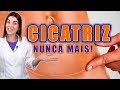 Adeus CICATRIZ no Rosto e no Corpo ! Saiba como TRATAR e PREVENIR CICATRIZES