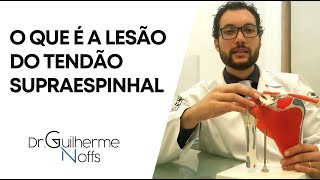 Lesão do Tendão Supraespinhal  Dr Guilherme Noffs