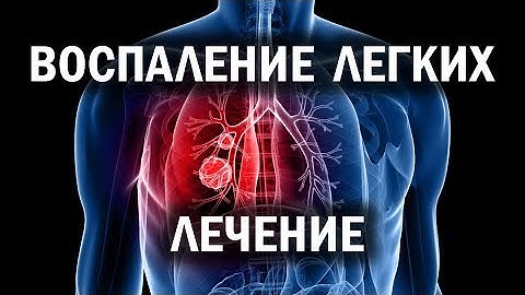 Воспаление легких лечение. APLGO результаты. Клеточное питание APL