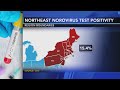 Contagious stomach bug circulating in the Northeast | Know the symptoms