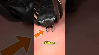 Why a Radioactive Spider Bite Would NEVER Turn You Into Spider-Man #youtubeshorts