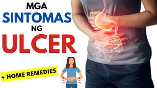 11 Sintomas Ng Ulcer Bakit Nagkaka-Ulcer At Ano Ang Home Remedies Para Dito? Stomach Ulcer