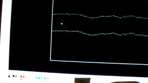 Arduino SoftPot potentiometer game