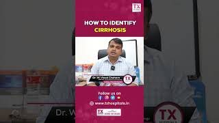 How to Identify CIRRHOSIS || DR. Vinod || Best @gastroenterologist in #hyderabad || TX Hospitals