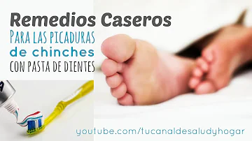 ¿Es buena la pasta de dientes para las picaduras de chinches?