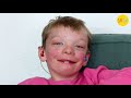 A Kid with One of the World&#39;s Rarest Disorders (1 of 4 Known Cases)