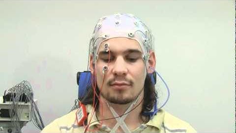 Physiologic artifacts of EEG (NeurOne)