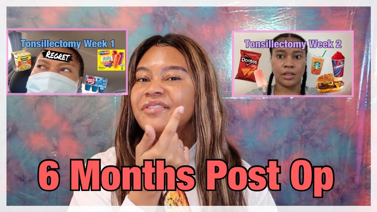 Adult Tonsillectomy 6 Month Post Op Update YouTube Adult Tonsillectomy 6 Month Post Op Update YouTube