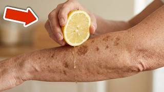5 tricks to make age spots disappear in 20 minutes Super easy