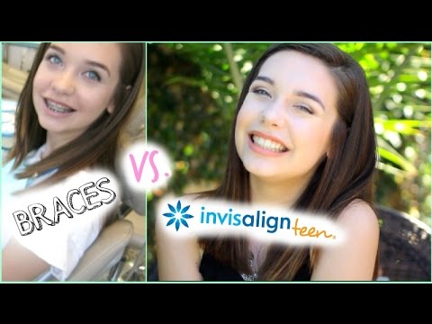 Introducing Invisalign Teen We Consulted