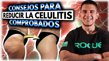 ¿Caminar elimina la celulitis de los glúteos?