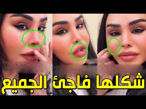 صغرت 20 سنة أحدث ظهور للفنانة الإماراتية أحلام بعد عملية تجميل وسبب إجراء العملية الحقيقي سيصدمكم