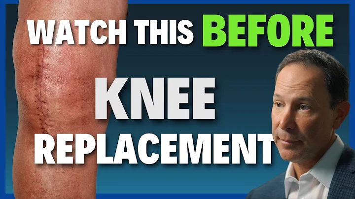 DON'T Get Knee Surgery Until You Watch This! (Doctor’s Honest Breakdown)