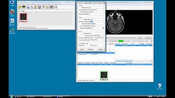 DICOM Tool - Exporting Images from Analyze