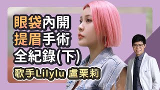 眼袋內開、提眉手術自我全紀錄Lilylu盧栗莉下雅丰麗緻診所 陳承謙醫師 feat.Lilylu盧栗莉 @lilylu7465