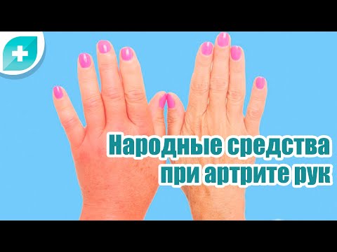 Лечение суставов на пальцах рук народными средствами в домашних условиях