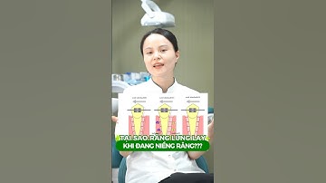 Răng lung lay nhẹ khi niềng răng có sao không? #nhakhoagreenlife #niengrang