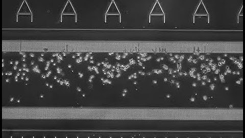 Fibroblast Migration with FBS Gradient Perfusion
