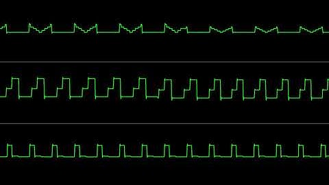 Toni Lönnberg (!Cube) - "Blink" [Atari STe] (Chiptune Visualization)