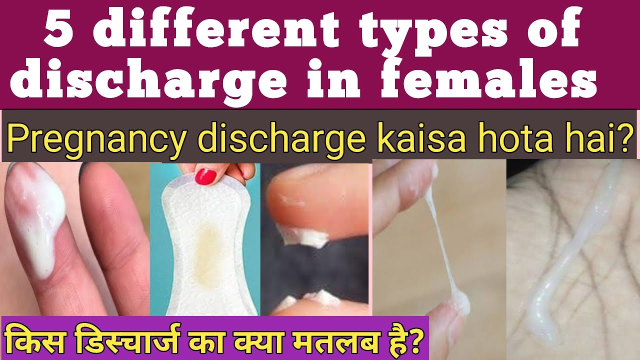 5 types of Discharge in females kis discharg ka kya matlab hota hai pregnancy discharge kaisa