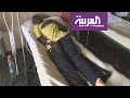 جنوب السودان يقترب من أول مستشفى لعلاج الفشل الكلوي جنوب السودان يقترب من أول مستشفى لعلاج الفشل الكلوي