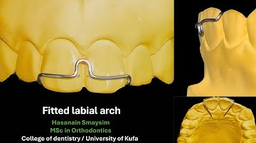 Fitted labial arch wire bending, design animation, adjustment and action simulation (voiced)