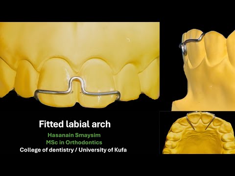Fitted labial arch wire bending, design animation, adjustment and action simulation (voiced)