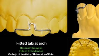 Fitted labial arch wire bending, design animation, adjustment and action simulation (voiced)