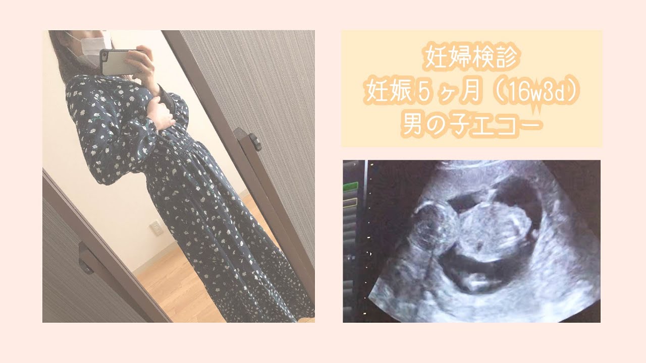 妊婦健診 性別判明 19w男の子エコー 4dエコー Youtube