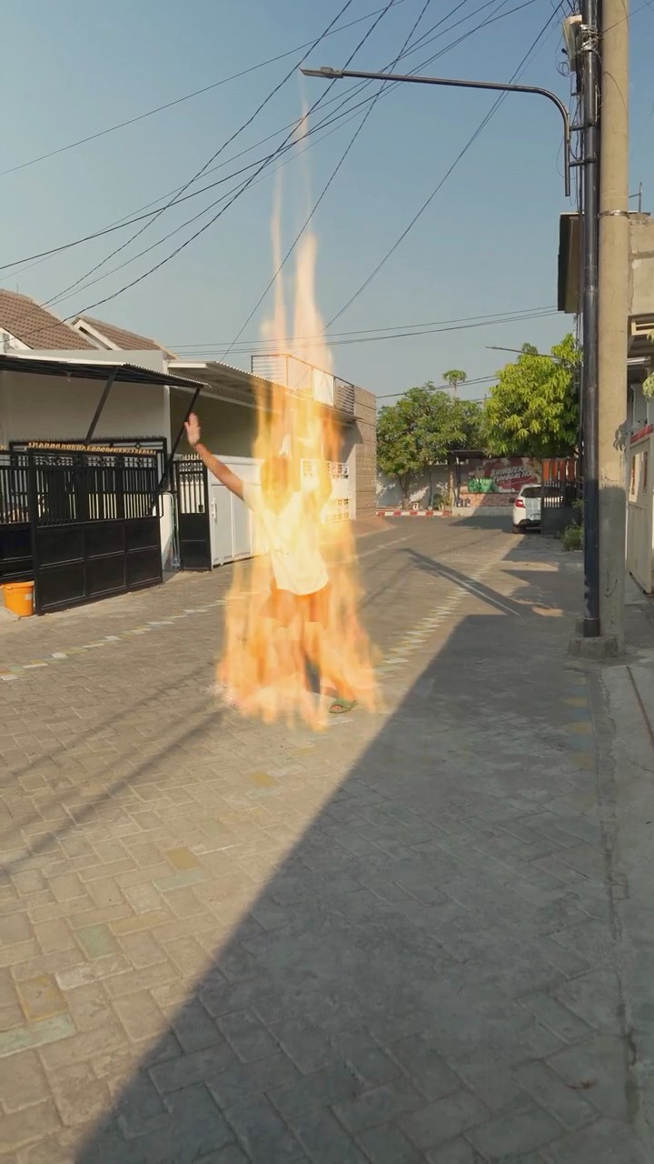kulit terbakar