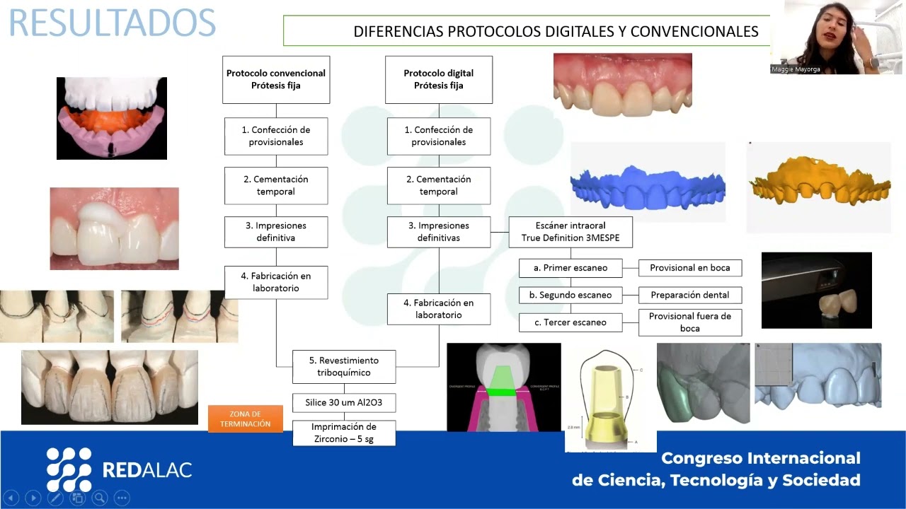 BOPT: una técnica de preparación vertical para dientes e implantes