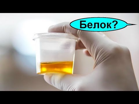 Video: Эмне үчүн альбумин заарада болот?