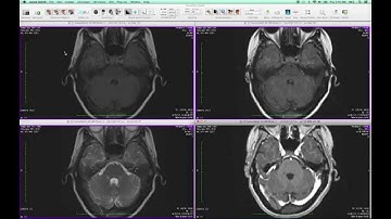 FusionSync Tutorial - Part 01: Quickstart