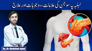 Pancreatitis | Acute Pancreatitis | Chronic Pancreatitis Causes, Symptoms & Treatment in Urdu