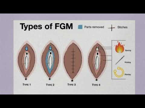 Female Genital Mutilation