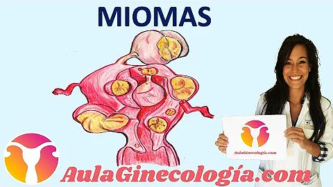 ¿Puede un ginecólogo ver los miomas?