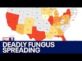 Deadly fungal infection spreading rapidly across U.S.