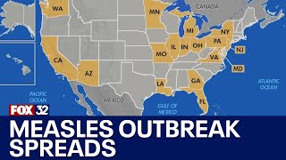 Measles outbreak spreads across the country