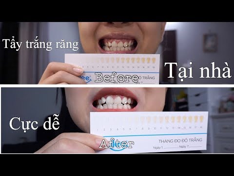 1 Tuần Tẩy Trắng Răng Tại Nhà  - Thỏ Tẩy Trắng Răng Tại Nhà Như Thế Nào ? | Con Thỏ