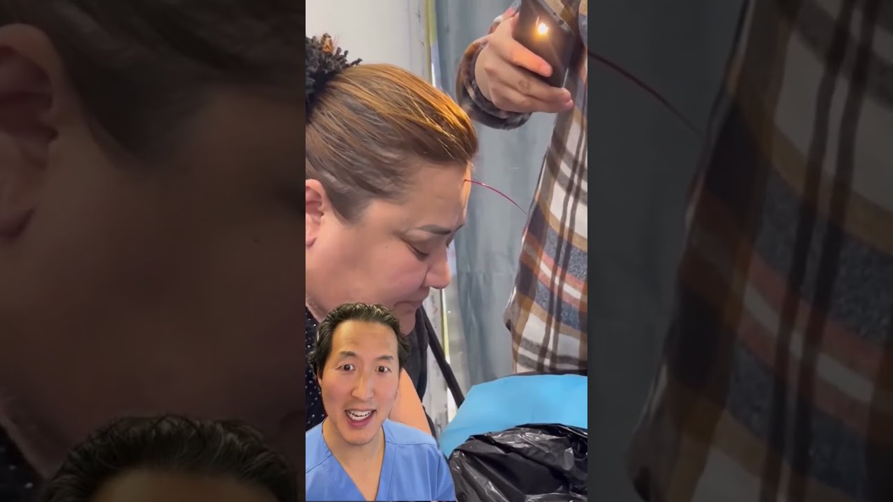 Why Are They Bleeding Her Phlebotomy