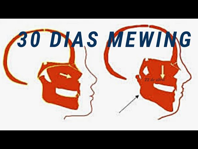 O que é Mewing? Introdução a prática do Mewing Passo-a-Passo
