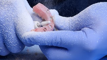 Section D: Contouring the Denture - Smart Denture Conversions Video Training