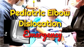 Pediatric Elbow Dislocation: How to Recognize and Treat