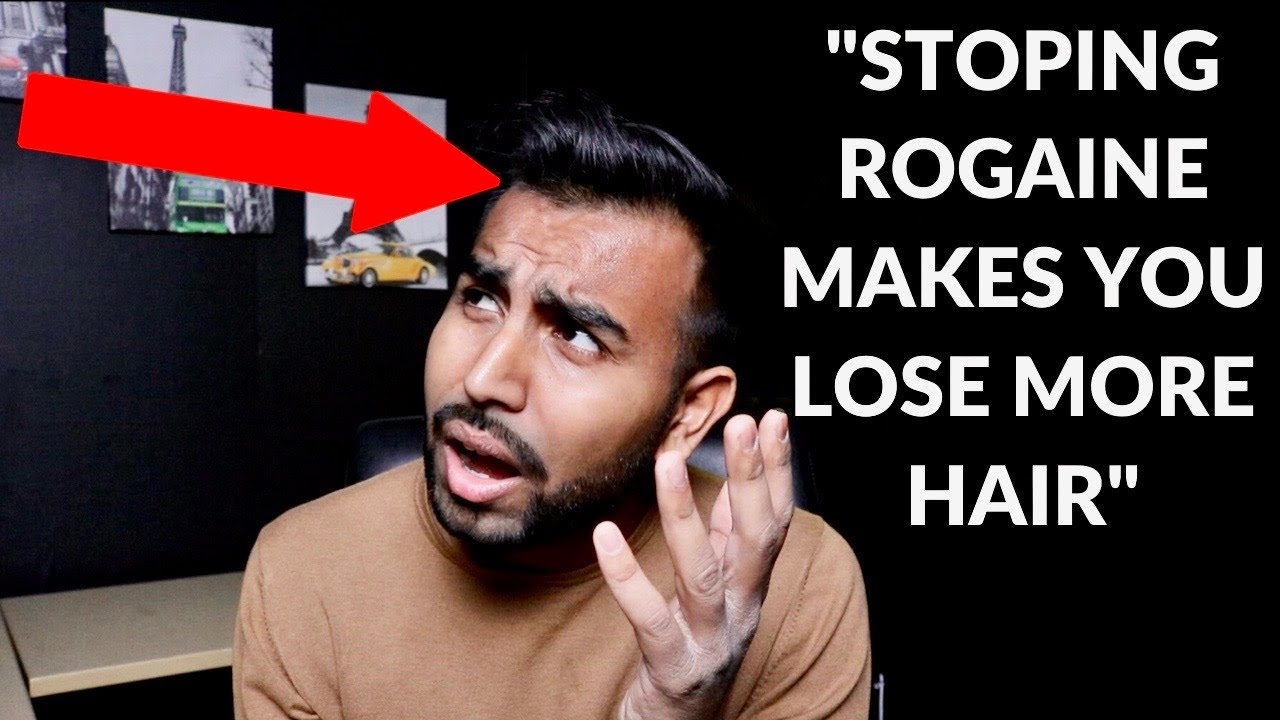 Does Stopping Rogaine Cause More Hair Loss?!? | - YouTube