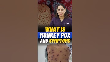What Is Monkey POX Virus I Symptoms & Precautions