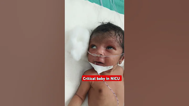 critical baby in NICU #serious #babyboy #nicu #premature