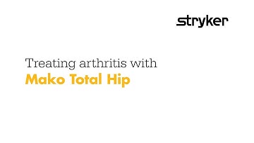 Joint Replacement - Mako Robotic Surgery | Baptist Health System